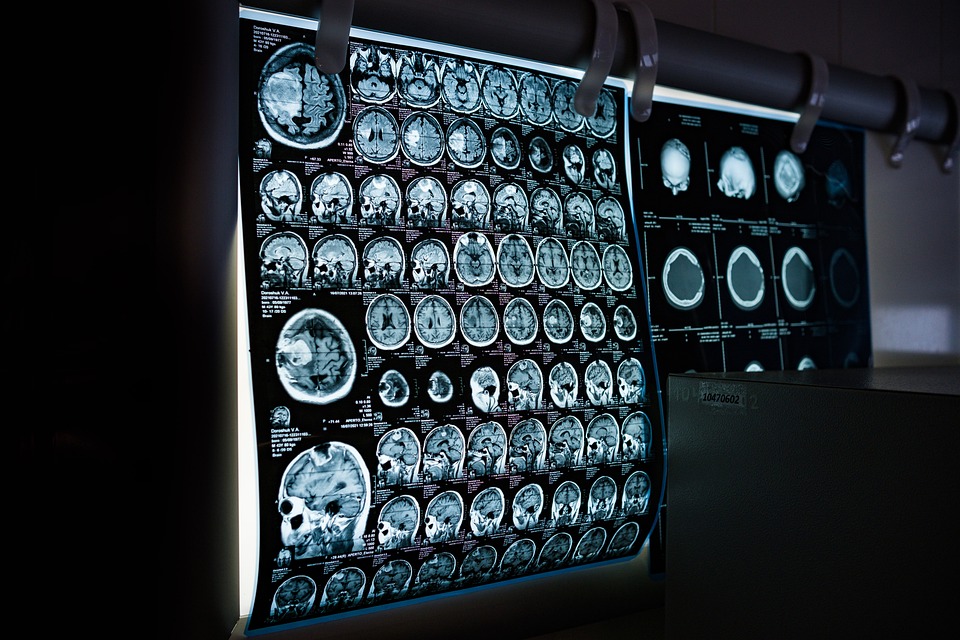 Tomografía por emisión de positrones (PET) - Tecnología de imágenes de medicina nuclear